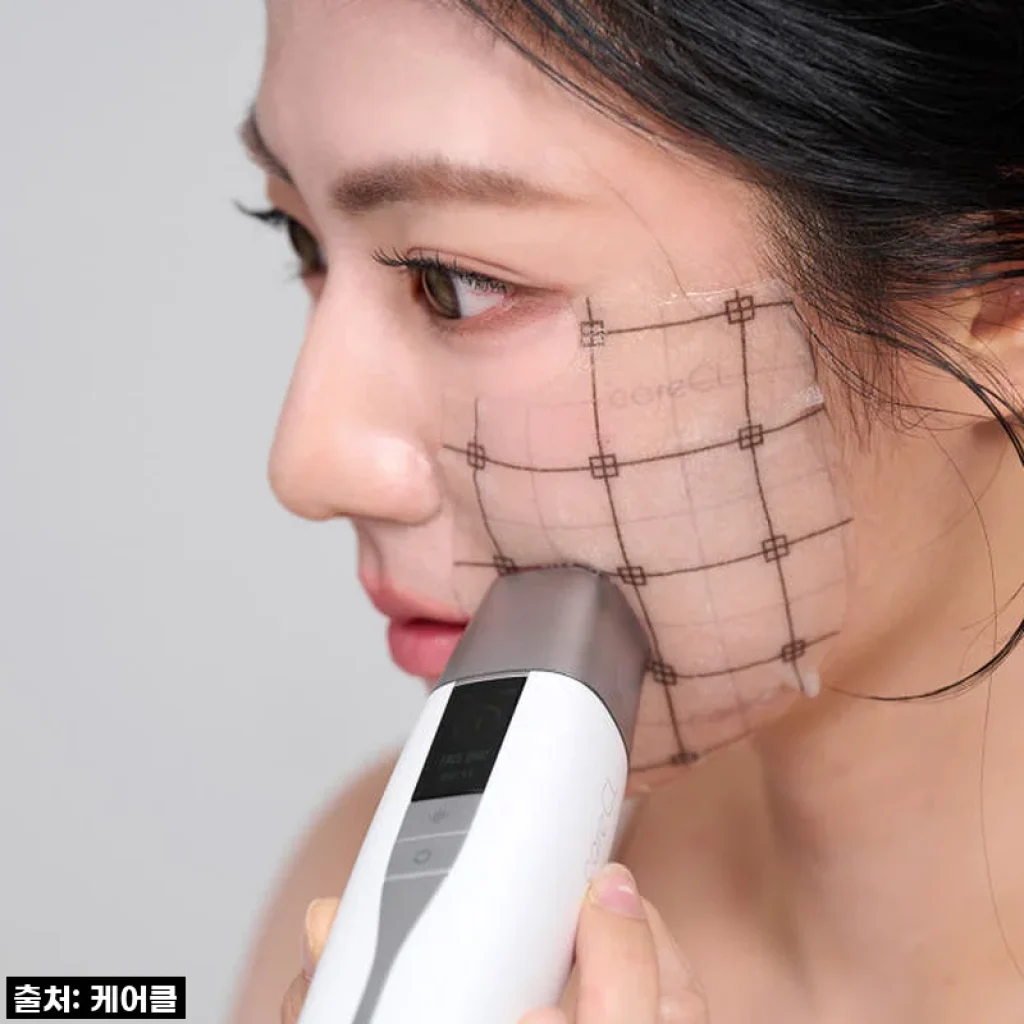피부과 이제 안녕! 집에서 매일 관리하는 케어클 테크핏 스탬핑 고주파 마사지기, 찐 후기!