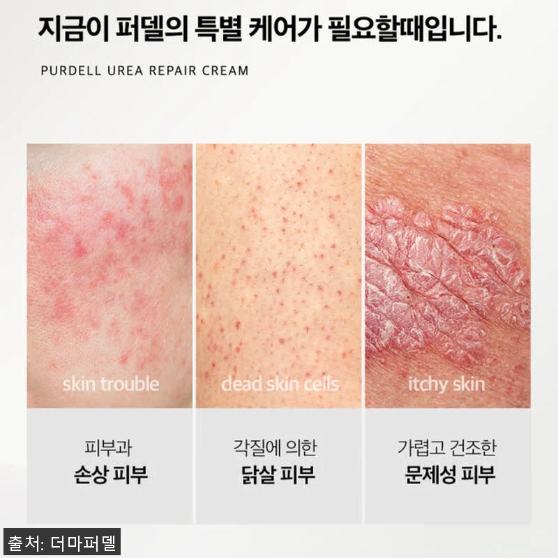더마퍼델 우레아 70000ppm EG 관련 이미지 3