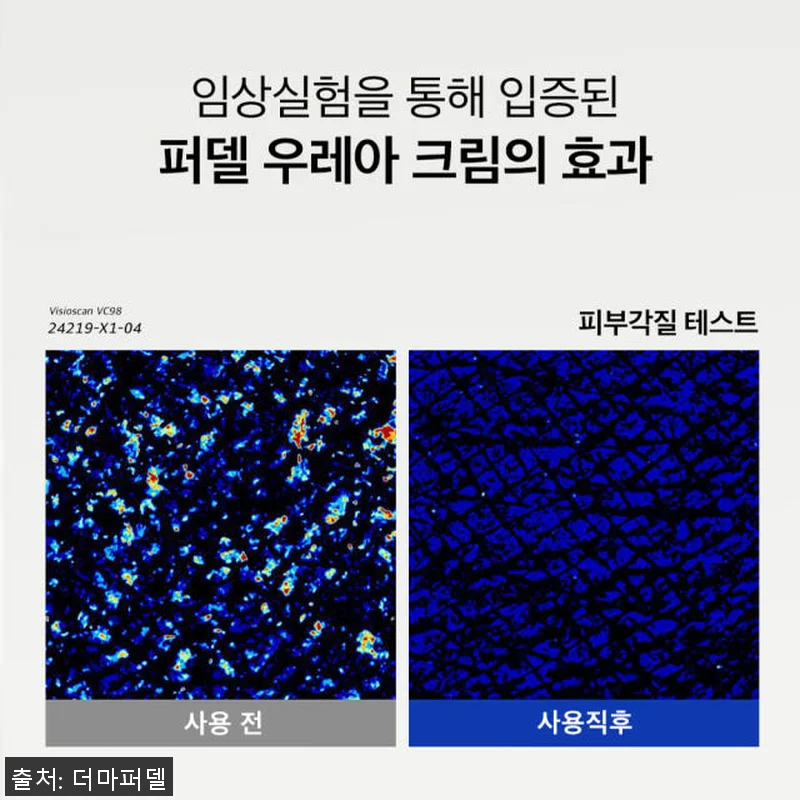 더마퍼델 우레아 70000ppm EG 관련 이미지 8