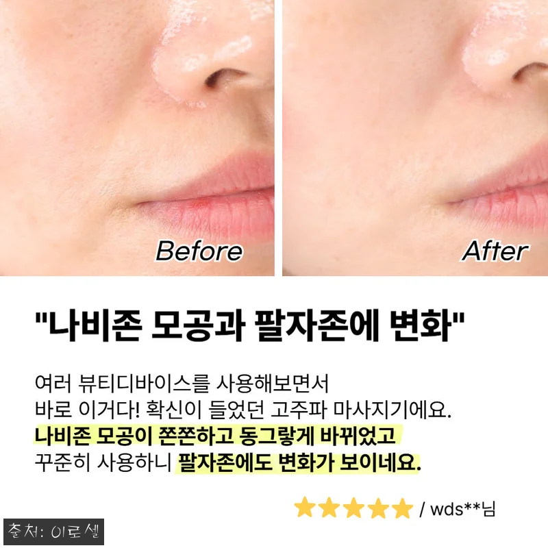 써마랩 고주파 마사지기 갈바닉 얼굴 관련 이미지 3