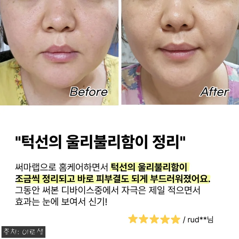 써마랩 고주파 마사지기 갈바닉 얼굴 관련 이미지 4