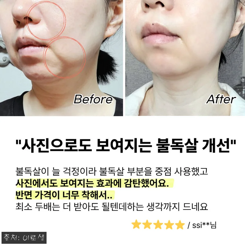 써마랩 고주파 마사지기 갈바닉 얼굴 관련 이미지 5